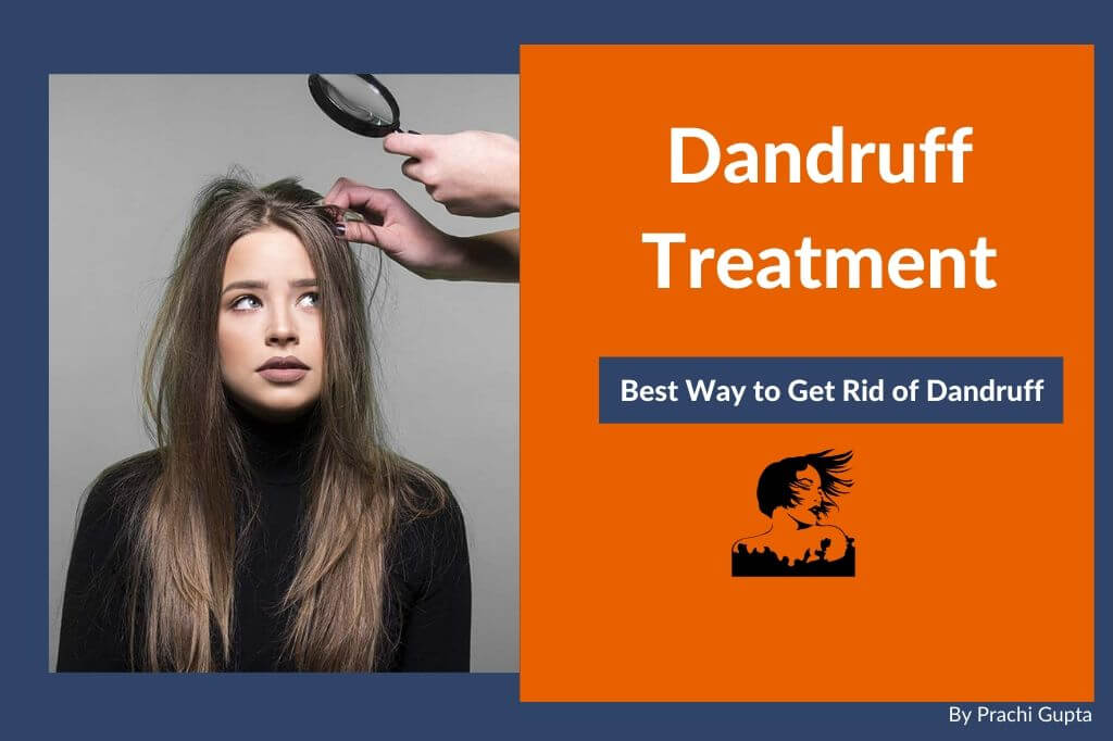 Dandruff treatment home remedies